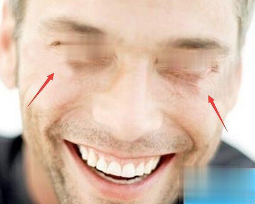 如何用ps去除照片中的皱纹(5)