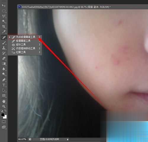 ps怎么去掉脸上的痘痘(2)