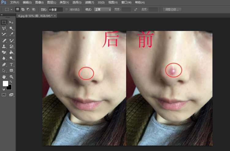 使用Photoshop为图片人物去痘印操作方法介绍